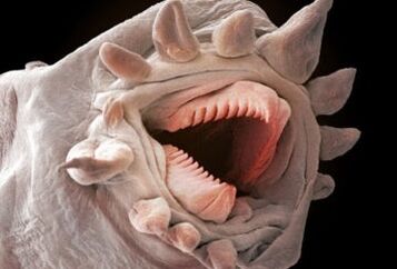 kokie kirminai gali gyventi žmogaus kūne